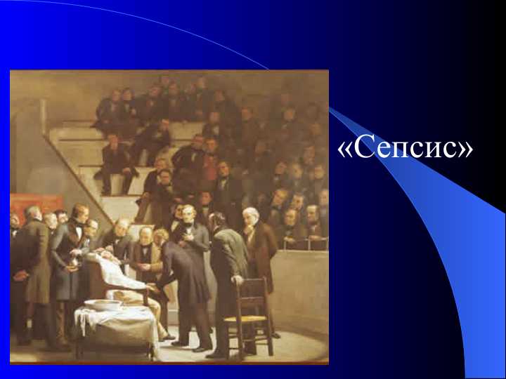 Сепсис/ sepsis