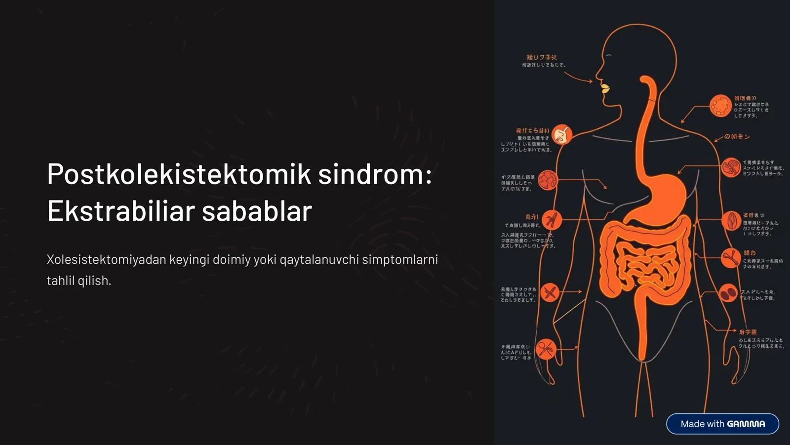 Postkolekistektomik sindrom