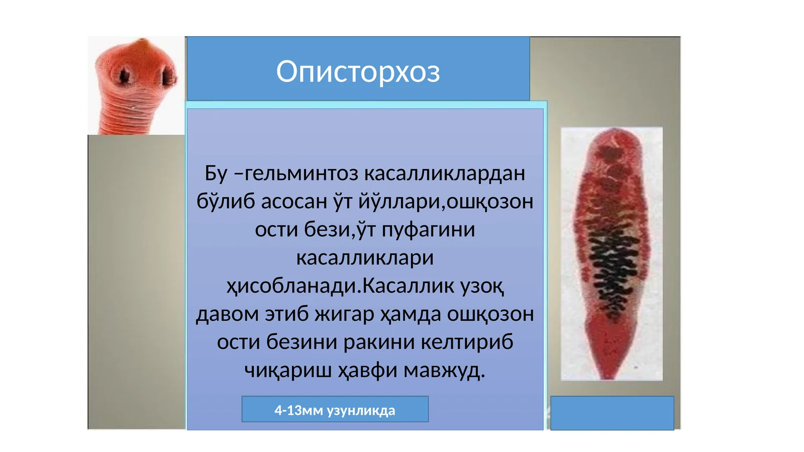 Описторхоз