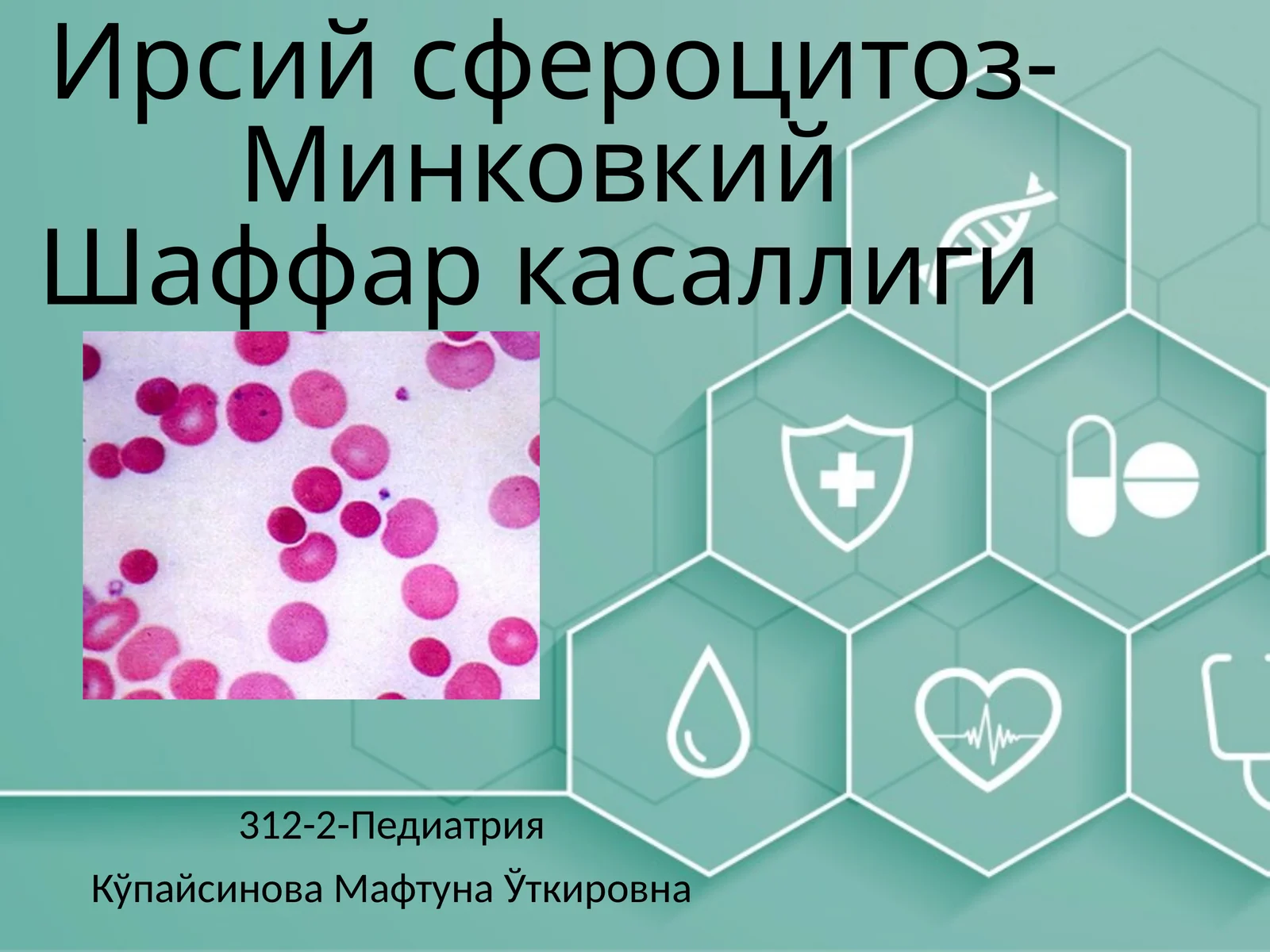 Ирсийсфероцитоз-МинковкийШаффаркасаллиги(gematologiya)