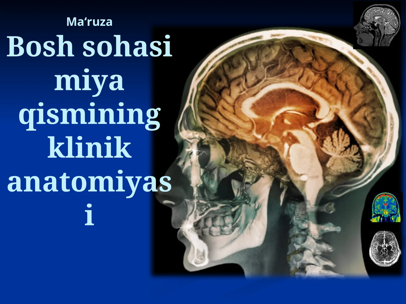 Maʻruza Bosh sohasi miya qismining klinika anatomiyasi