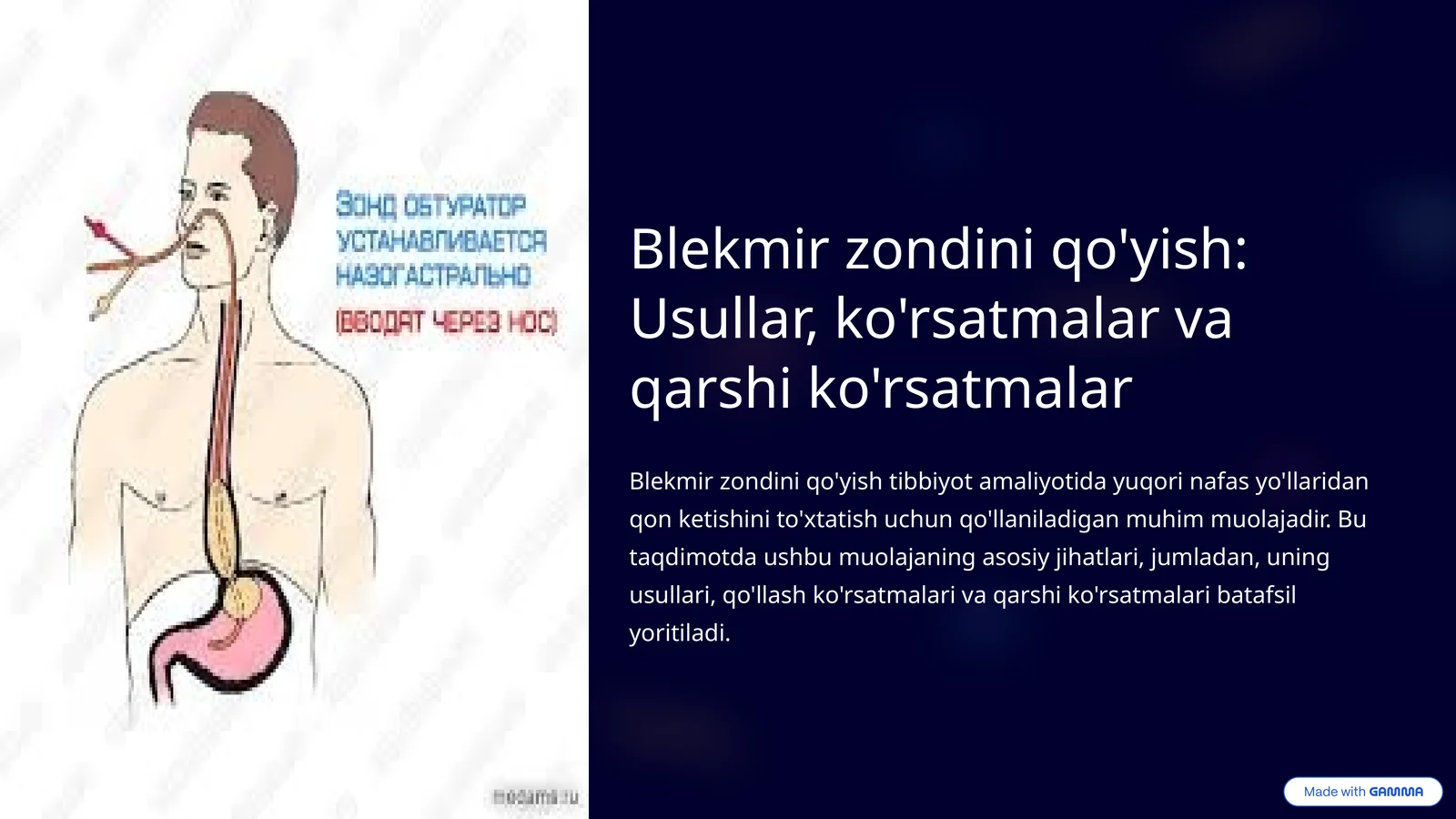 Blekmir zondini qo'yish: Usullar, ko'rsatmalar va qarshi ko'rsatmalar