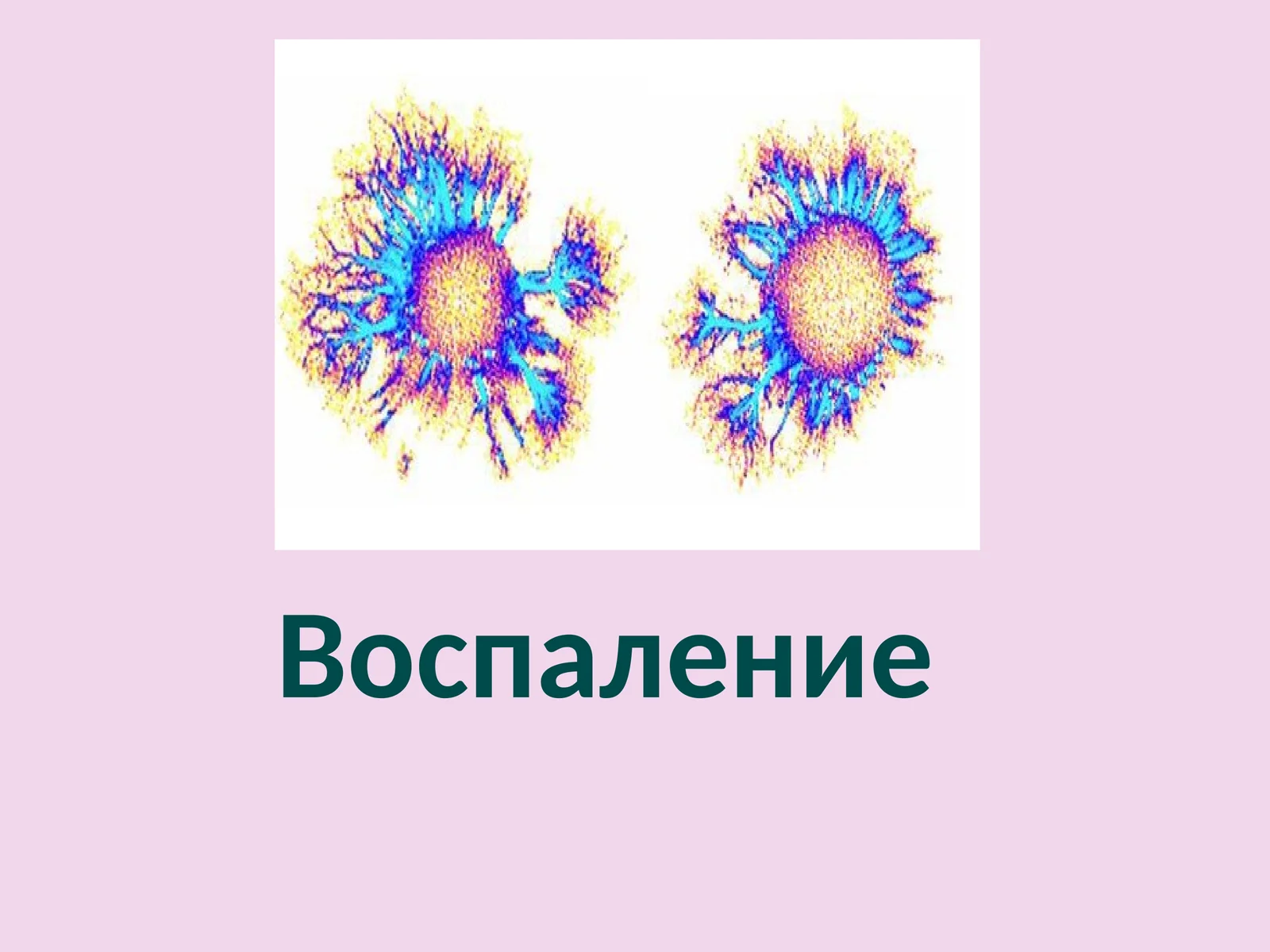 Воспаление