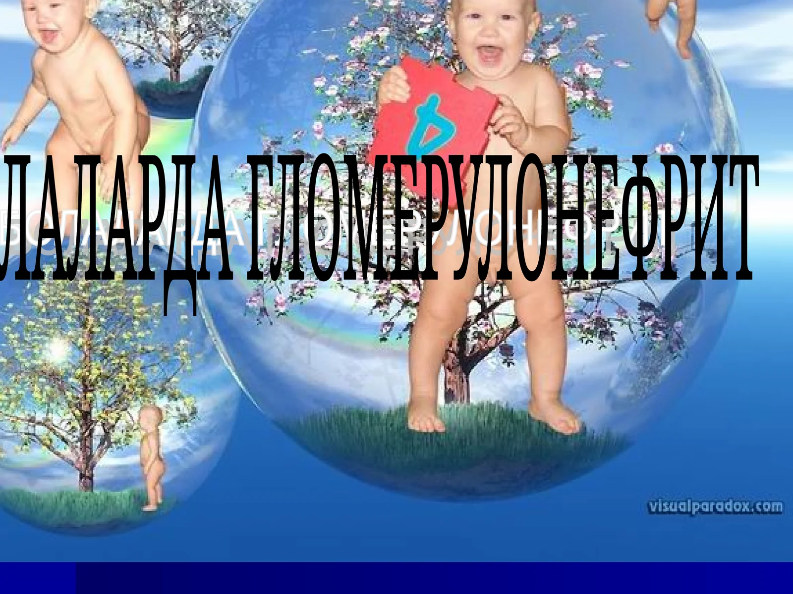 Болаларда гломерулонефрит