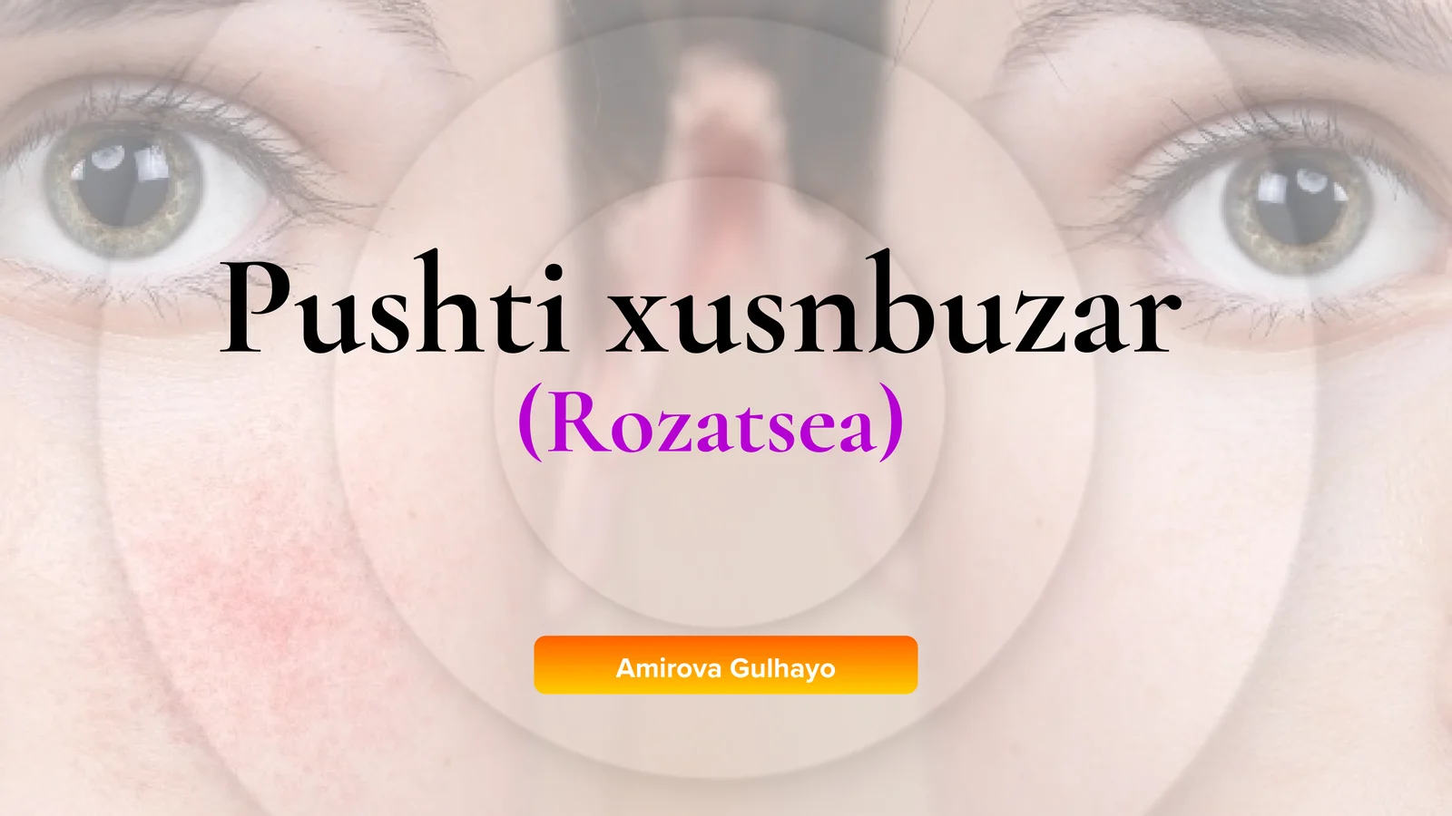 Pushti xusnbuzar (Rozatsea)