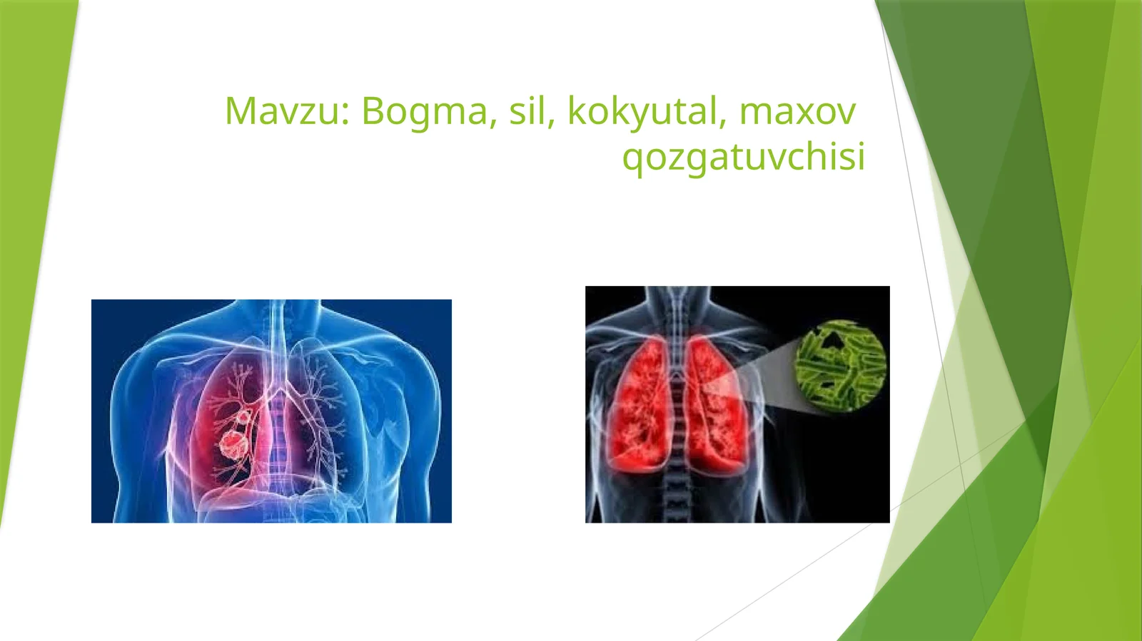 Bogma,sil,kokyutal,maxovqozgatuvchisi