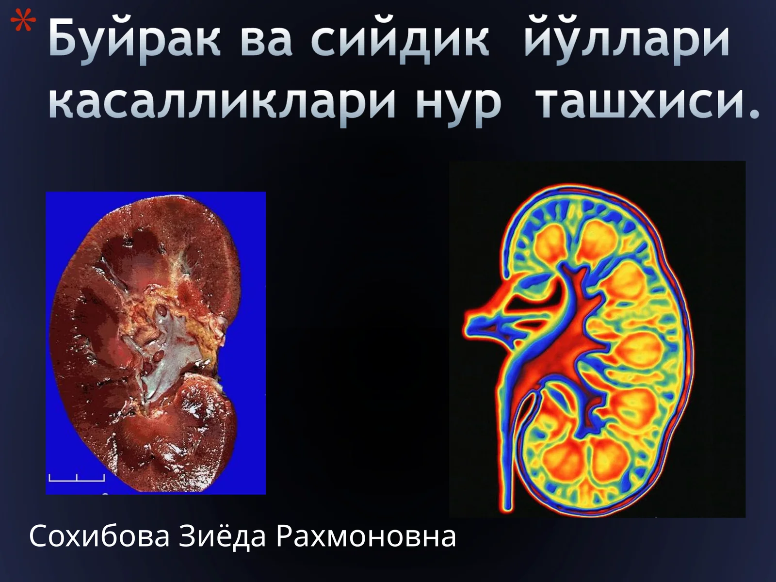 Сонография –УТТ