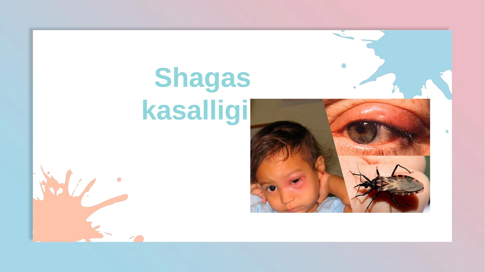 Chagas kasalligi - Trypanosoma cruzi (T. cruzi) parazitidan kelib chiqqan yuqumli kasallik