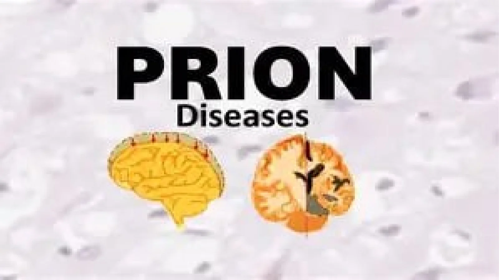Prion Kasalliklari
