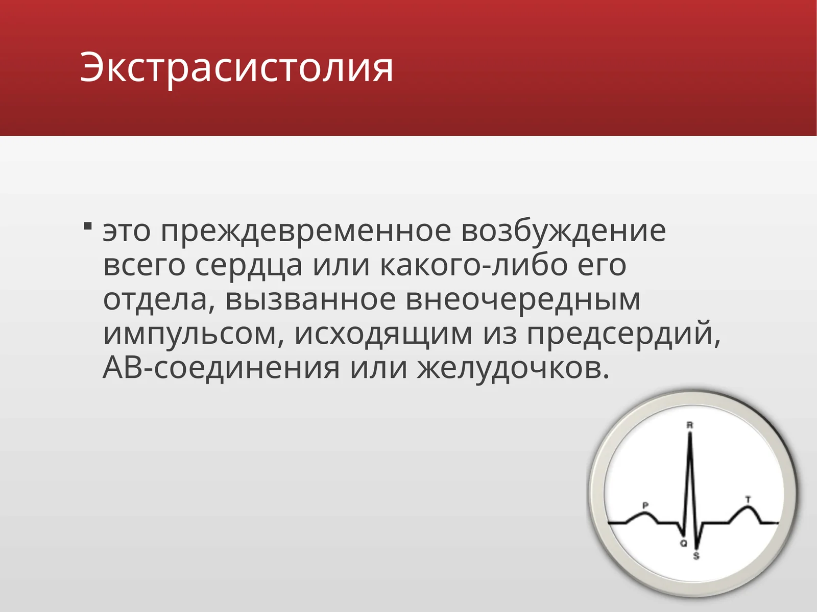 Экстрасистолия