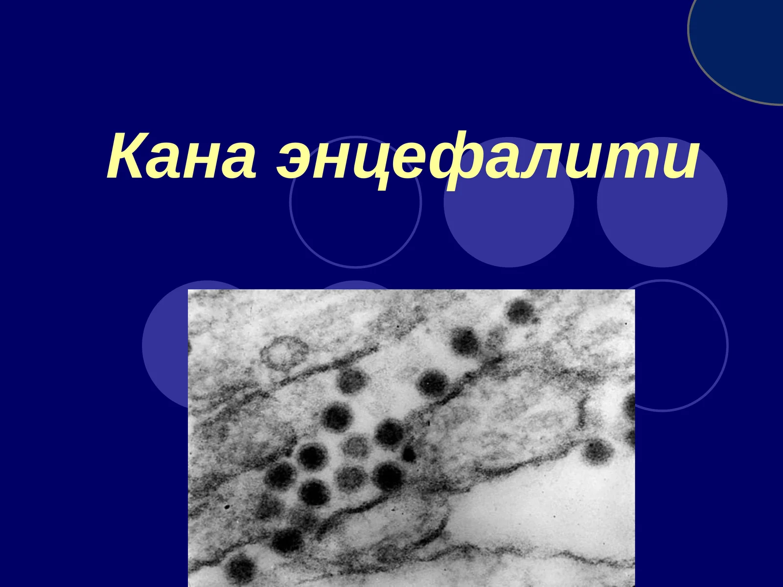 Кана энцефалити