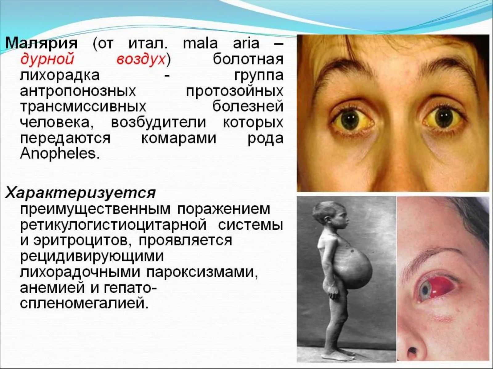 malyariya ppt