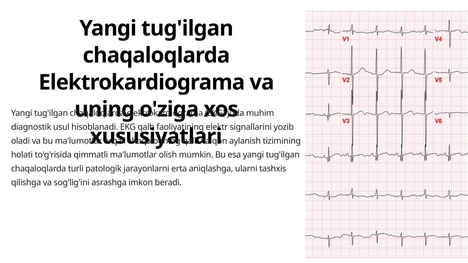 Yangi tug'ilgan chaqaloqlarda Elektrokardiograma va uning o'ziga xos xususiyatlari