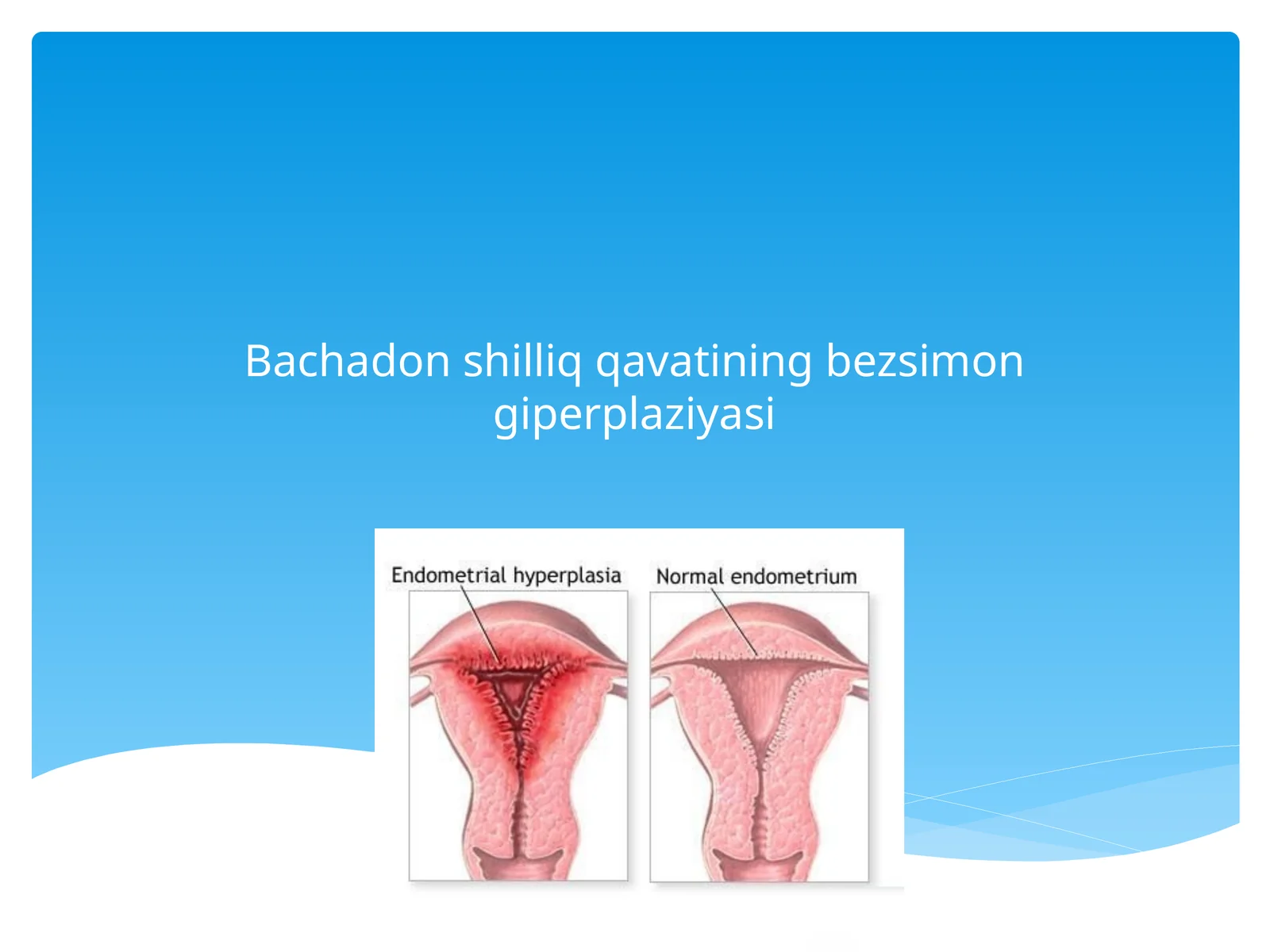 Bachadonshilliq qavati ning bezsimon gi perplaziyasi