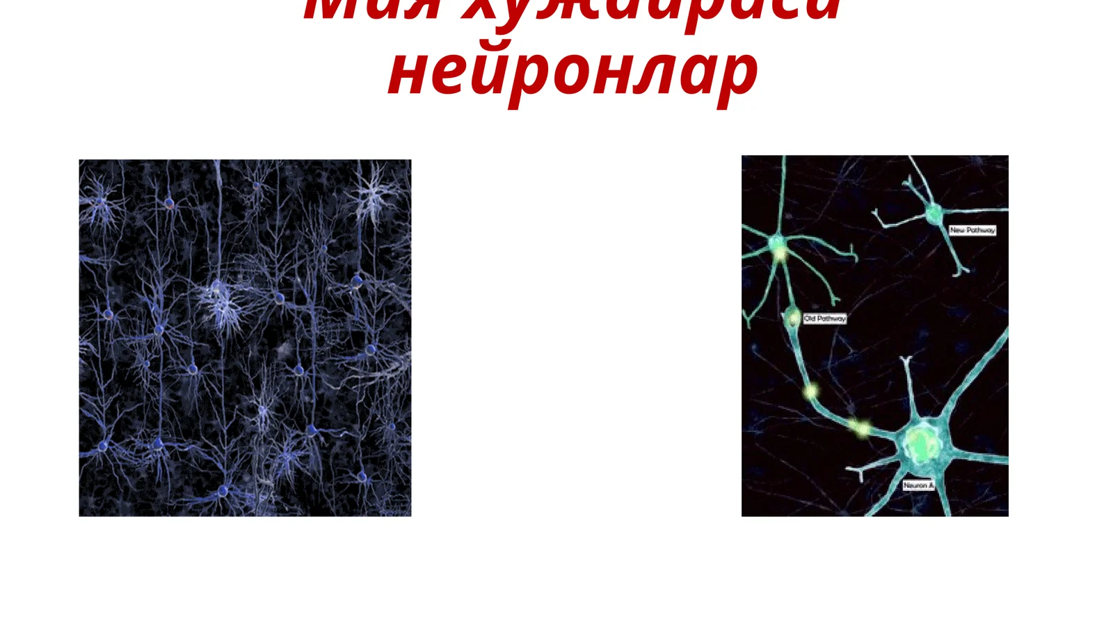 Мия хужайраси нейронлар