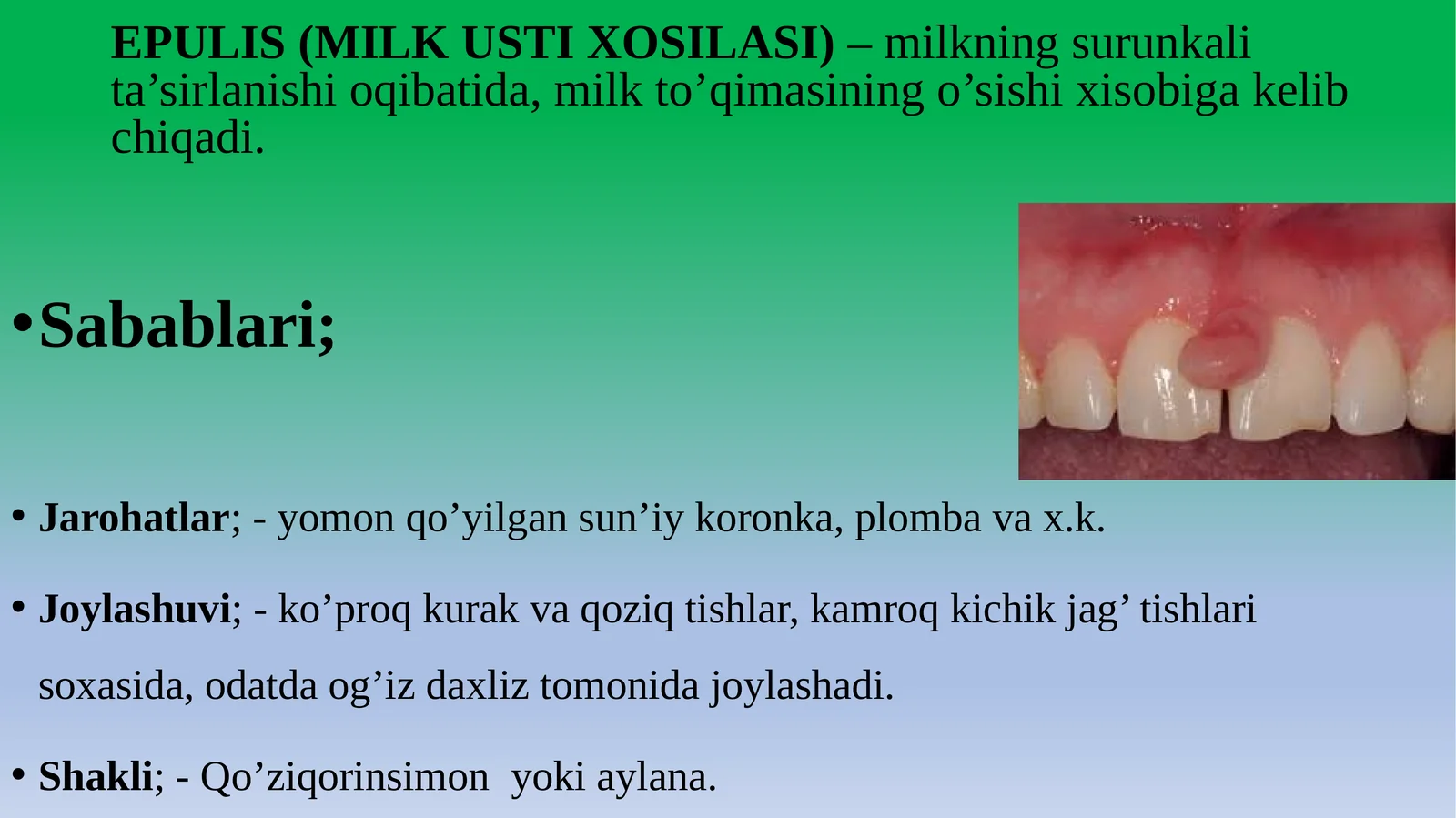 EPULIS (MILK USTI XOSILASI)