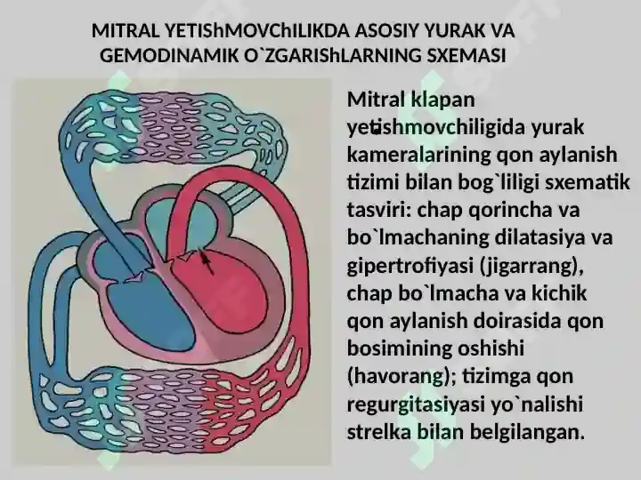 Yurak Ritm Yurak mitral va aortal nuqsonlari.Yurak orttirilgan nuqsonlari