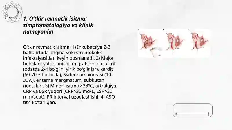 Yurak Ritm Yurak Ritmini Buzilish Sindromi